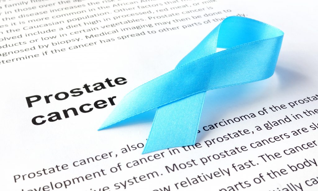 prostate cancer, prostate cancer screening, alternative prostate cancer treatment